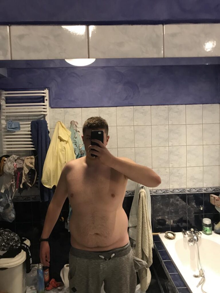 Otyły Antoni przed schudnięciem 30 kilogramów